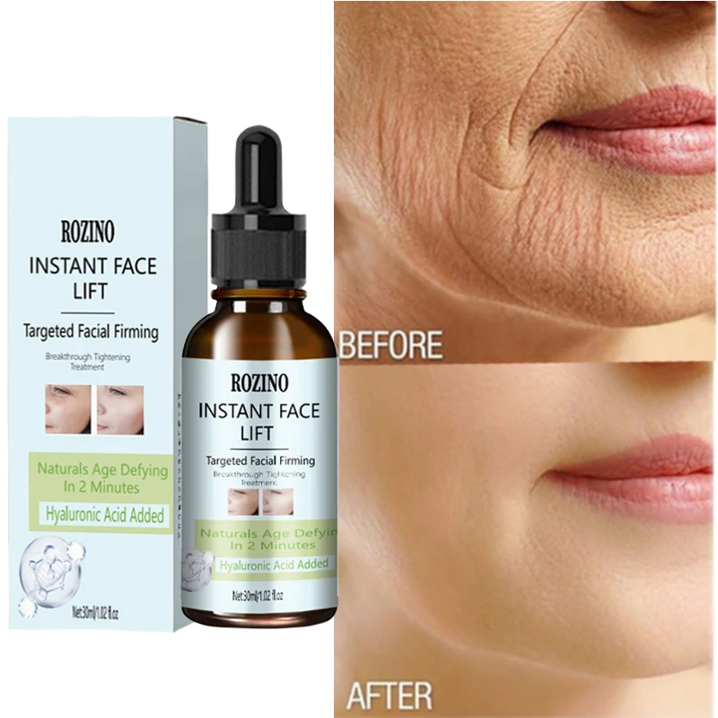 Hyaluronic Acid Serum Dark Spot Remover For Face Lifting Firming Rejuvenating Cream Moisturizer Korean Skin Care Cosmetics 30ml
Hyaluronic Acid Serum Dark Spot Remover For Face Lifting Firming Rejuvenating Cream Moisturizer Korean Skin Care Cosmetics 30ml