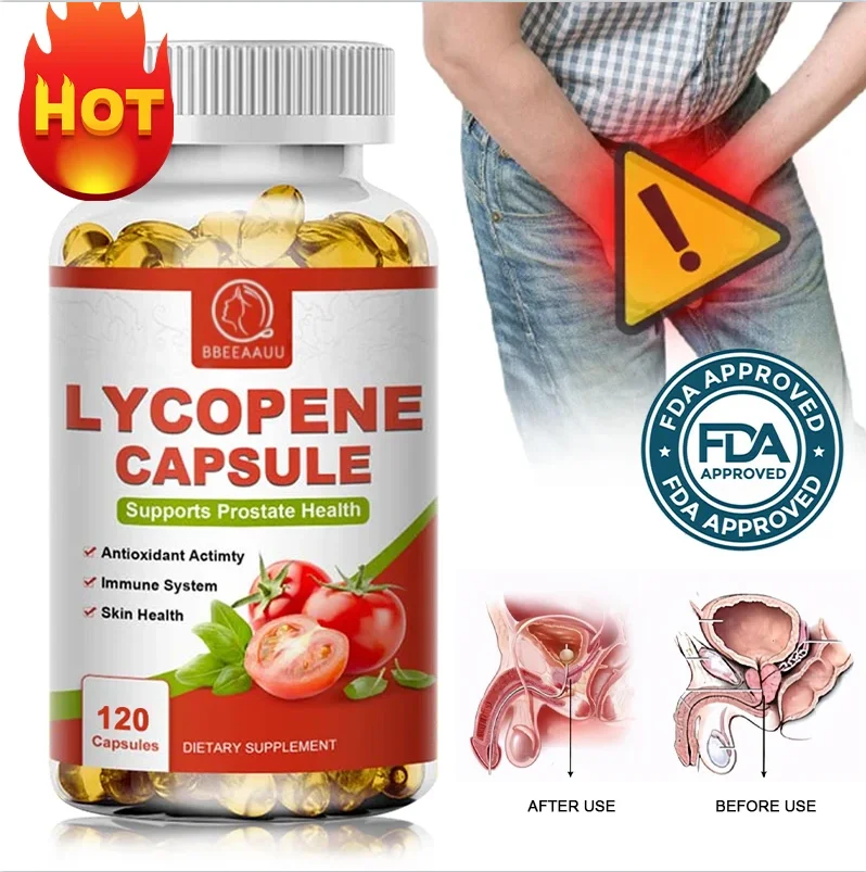 Lycopene Capsule for Prostate Health Relieve Urinary Tract Pain, Frequency, Urgency&Incontinence Improves Fertility Heart Health
Lycopene Capsule for Prostate Health Relieve Urinary Tract Pain, Frequency, Urgency&Incontinence Improves Fertility Heart Health