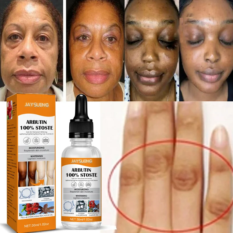 30ML Arbutin Skin Whitening Serum Face Serum Bleaching Cream Skin Spot Purifying Serum Dark Spot Remover Cosmetics Skin Care
30ML Arbutin Skin Whitening Serum Face Serum Bleaching Cream Skin Spot Purifying Serum Dark Spot Remover Cosmetics Skin Care