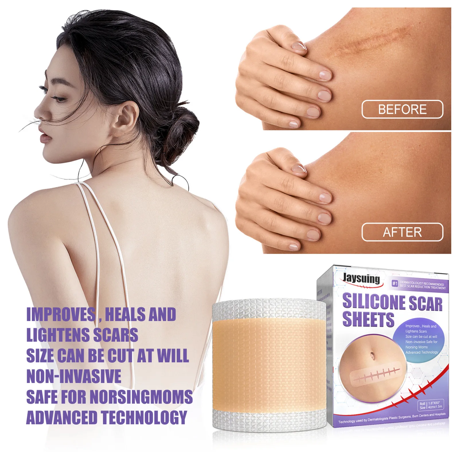 Self-adhesive Silicone Scar StickersEfficient Surgery Scar-removal Gel Patch Surgical Scar-removal Sheets For Scars
Self-adhesive Silicone Scar StickersEfficient Surgery Scar-removal Gel Patch Surgical Scar-removal Sheets For Scars