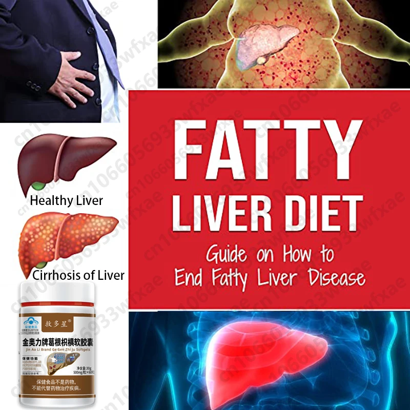Liver Detox Cleanse Supplement 30Day Liver Inflammation Relief Fat Metabolism Capsules Suppport Aids Healthy Liver Function Pill
Liver Detox Cleanse Supplement 30Day Liver Inflammation Relief Fat Metabolism Capsules Suppport Aids Healthy Liver Function Pill