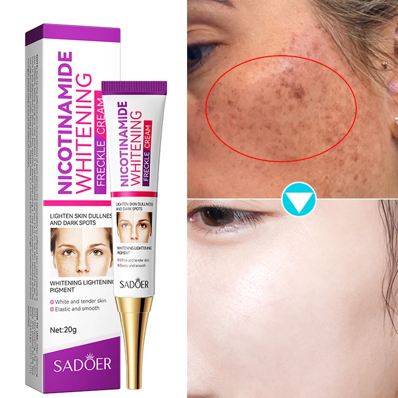 Nicotinamide Whitening Freckle Cream Remove Melasma Melanin Dark Spot Corrector Fade Acne Marks Moisturizing Brighten Skin Care
Nicotinamide Whitening Freckle Cream Remove Melasma Melanin Dark Spot Corrector Fade Acne Marks Moisturizing Brighten Skin Care