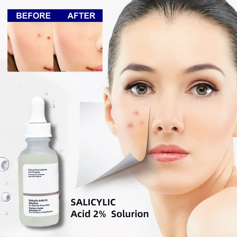 Skin Care Serum Original Niacinamide 10% Solution AHA 30% + BHA 2% Caffeine Solution Products Brighten Skin Care
Skin Care Serum Original Niacinamide 10% Solution AHA 30% + BHA 2% Caffeine Solution Products Brighten Skin Care