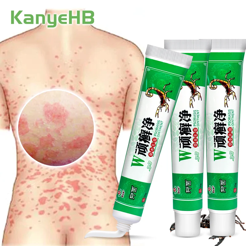 1-3-5pcs Scorpion Psoriasis Ointment Inhibit Fungus Treatment Cream Skin Medical Plaster Beriberi Medicine Dermatitis Eczema
1-3-5pcs Scorpion Psoriasis Ointment Inhibit Fungus Treatment Cream Skin Medical Plaster Beriberi Medicine Dermatitis Eczema