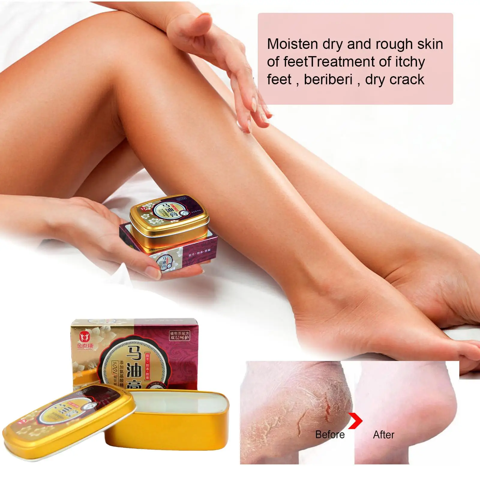 Horse Oil Anti-Drying Crack Foot Cream Heel Cracked Dead Hand Nourishing Repair Cream Care Hand Removal Skin Feet Care Oint S2S2
Horse Oil Anti-Drying Crack Foot Cream Heel Cracked Dead Hand Nourishing Repair Cream Care Hand Removal Skin Feet Care Oint S2S2