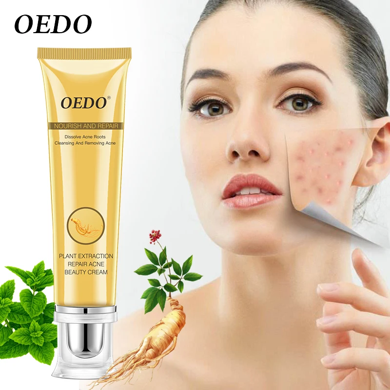 20g OEDO Plant Extraction Repair Acne Cream Ginseng Extract Facial Treatment Skin Repair Ointment Firmer Blackheads Pimples
20g OEDO Plant Extraction Repair Acne Cream Ginseng Extract Facial Treatment Skin Repair Ointment Firmer Blackheads Pimples