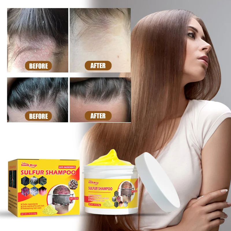 Sulfur Shampoo Scalp Removing Lice, Relieving Itching, Cleaning, Oil Control, Hair Follicle Removing Mites, Pimples, Scalp Care
Sulfur Shampoo Scalp Removing Lice, Relieving Itching, Cleaning, Oil Control, Hair Follicle Removing Mites, Pimples, Scalp Care