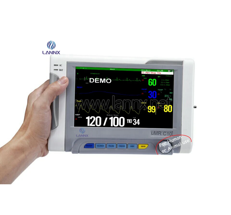 LANNX uMR C10 Hot Style Clinic Ambulance Multiparamete Patient Monitor For human or animal use Digital Vital Signs Monitors
LANNX uMR C10 Hot Style Clinic Ambulance Multiparamete Patient Monitor For human or animal use Digital Vital Signs Monitors