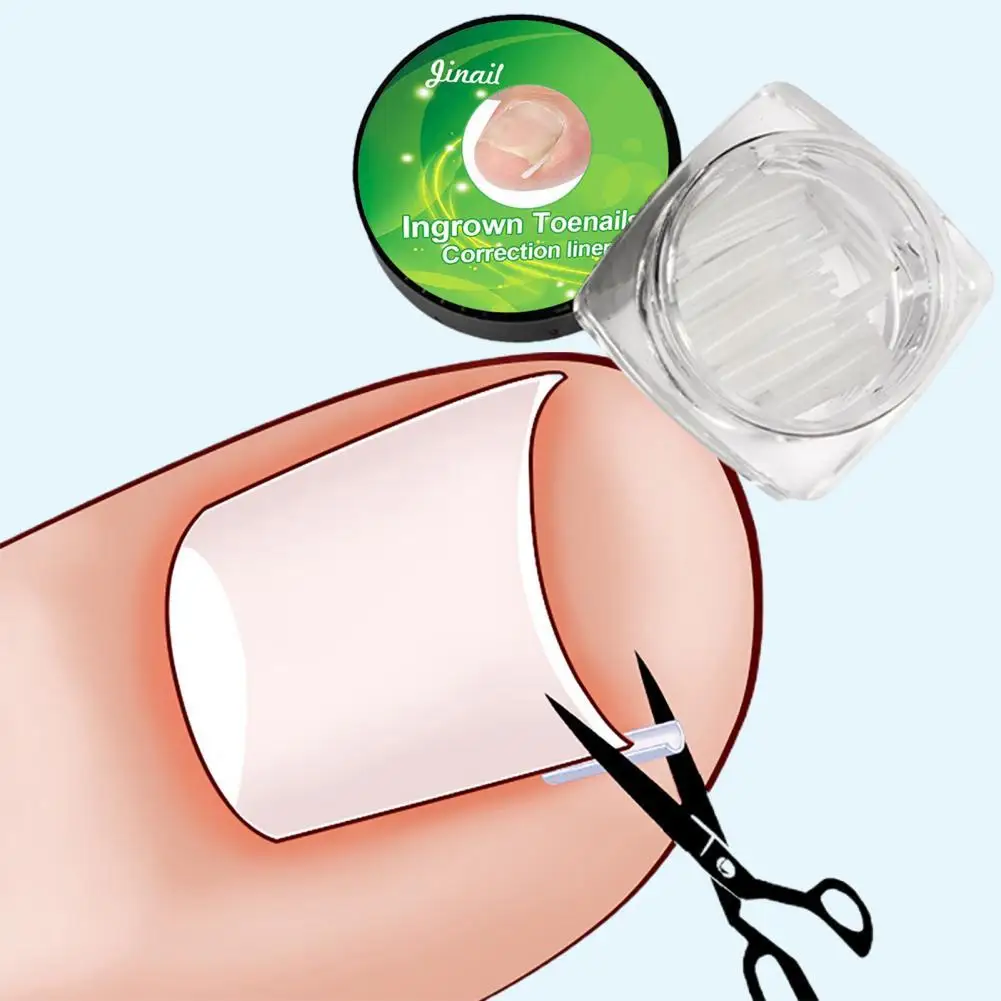 10pcs Ingrown Toenail Correction Tool Ingrown Toe Nail Treatment Elastic Patch Sticker Straightening Clip Brace Pedicure Tool
10pcs Ingrown Toenail Correction Tool Ingrown Toe Nail Treatment Elastic Patch Sticker Straightening Clip Brace Pedicure Tool