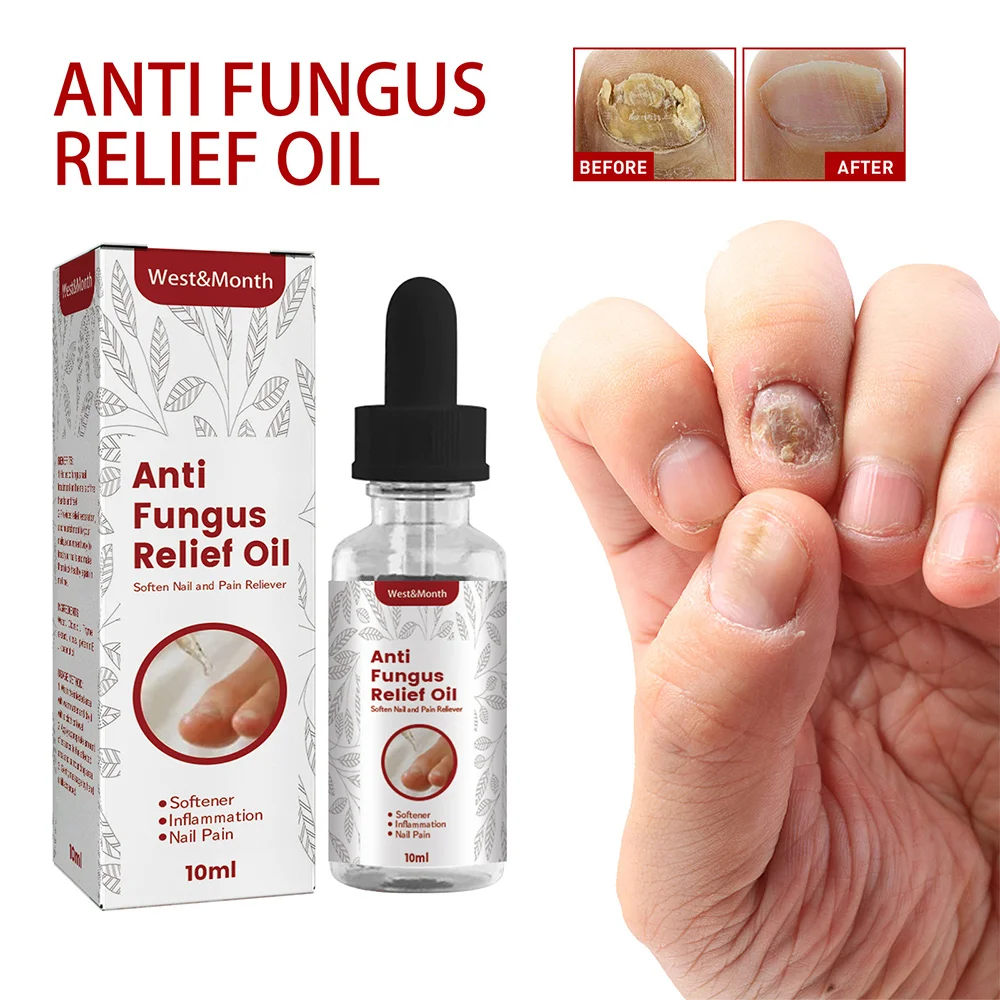 Nail Treatment Serum Hand Foot Nails Fungus Repair Care Toe Fungal Removal Cream Toenail Anti-infective Onychomycosis Gel 
Nail Treatment Serum Hand Foot Nails Fungus Repair Care Toe Fungal Removal Cream Toenail Anti-infective Onychomycosis Gel