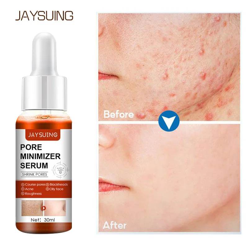 Salicylic Acid Acne Treatment Face Serum Shrink Pores Improve Blackheads Dots Oil Control Moisturizing Nourish Essence Skin Care
Salicylic Acid Acne Treatment Face Serum Shrink Pores Improve Blackheads Dots Oil Control Moisturizing Nourish Essence Skin Care