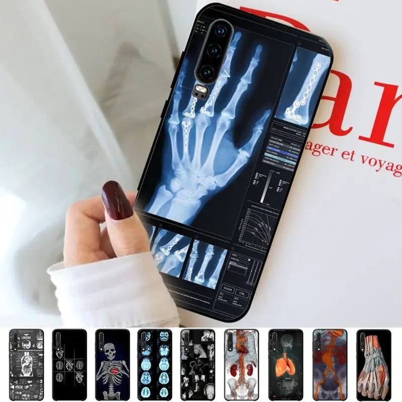 Radiological Human Organs Skeleton Skull Phone Case for Huawei P30 40 20 10 8 9 lite pro plus Psmart2019
Radiological Human Organs Skeleton Skull Phone Case for Huawei P30 40 20 10 8 9 lite pro plus Psmart2019