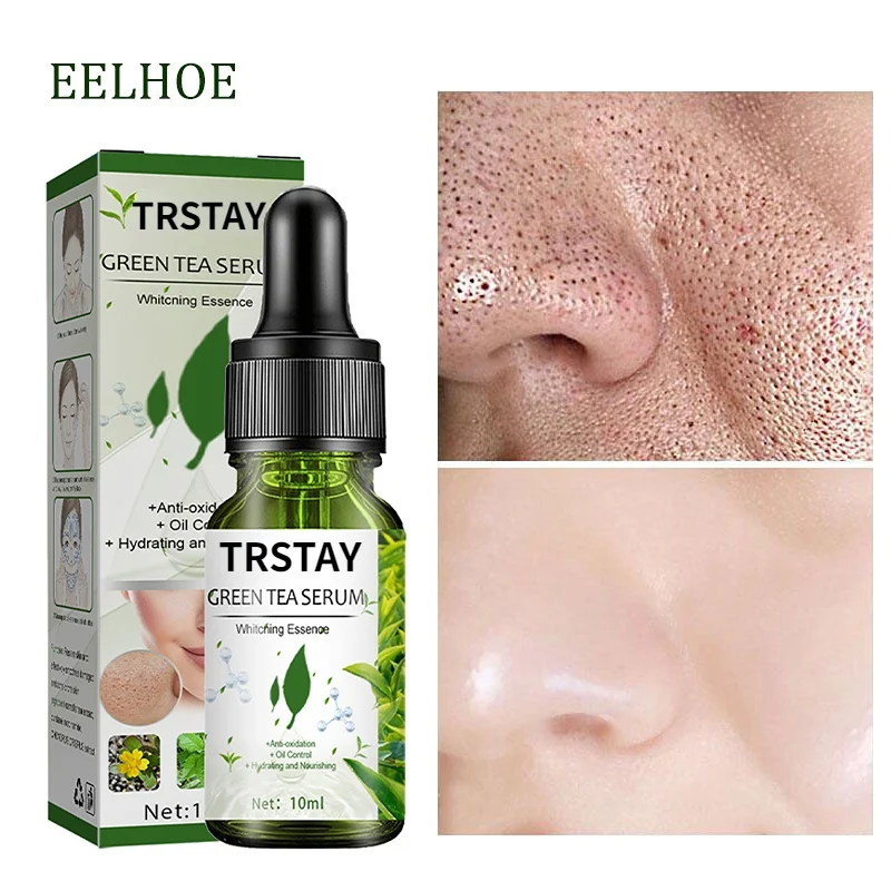 GreenTea PoreShrink Essence Balancing Oil Control Moisturizing Repair Acne Lotion Skin Reduction Serum face lift whitening cream
GreenTea PoreShrink Essence Balancing Oil Control Moisturizing Repair Acne Lotion Skin Reduction Serum face lift whitening cream