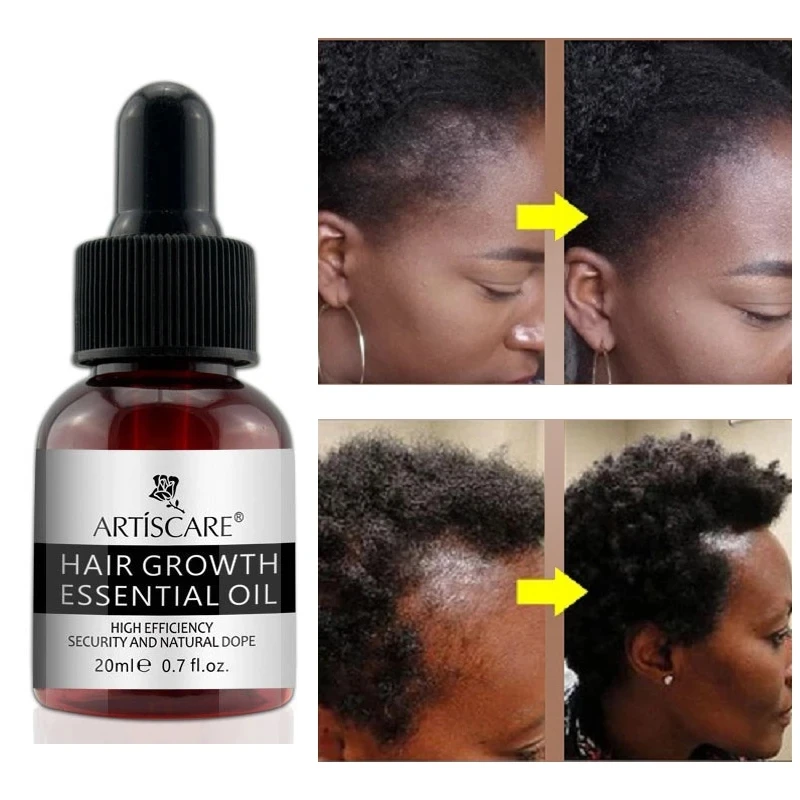 Ginger Hair Growth Essence Oils Products Anti Hair Loss Treatement Fast Growing Germinal Serum Prevent Scalp Damaged Men Women
Ginger Hair Growth Essence Oils Products Anti Hair Loss Treatement Fast Growing Germinal Serum Prevent Scalp Damaged Men Women