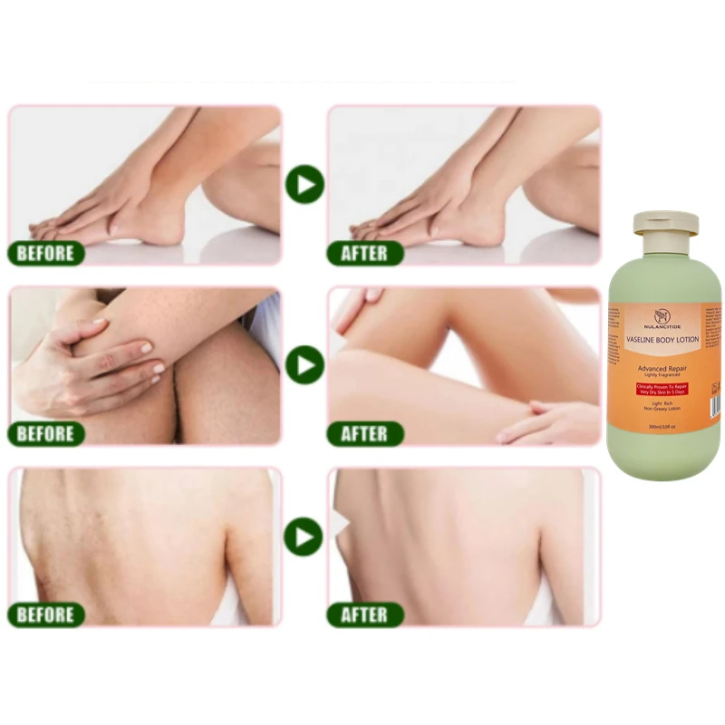 Вазелин увлажняет и предотвращает сухость и трещины, высыхает и увлажняет, отбеливает, нежно и гладкий лосьон для тела
Вазелин увлажняет и предотвращает сухость и трещины, высыхает и увлажняет, отбеливает, нежно и гладкий лосьон для тела