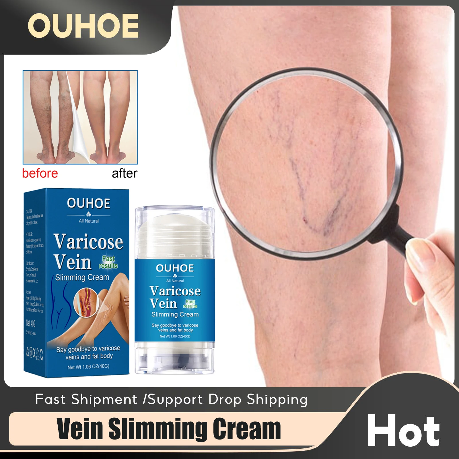 Varicose Veins Relief Cream Improves Blood Circulation Red Blood Streaks Varicosity Spider Pain Relieve Legs Tired Ointment 40g
Varicose Veins Relief Cream Improves Blood Circulation Red Blood Streaks Varicosity Spider Pain Relieve Legs Tired Ointment 40g