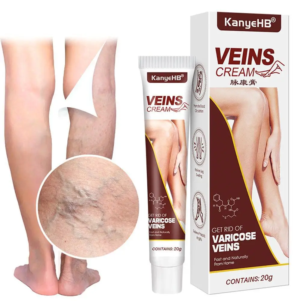 

20g Effective Varicose Vein Relief Cream Ointment For Varicose Veins To Relieve Vasculitis Phlebitis Spider Pain Treatment
