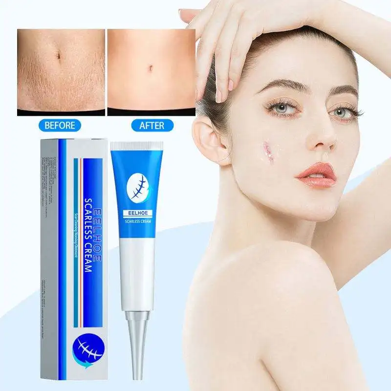 Effective Scar Removal Cream Stretch Marks Burn Surgical Scars Treatment Pimples Acne Spots Repair Gel Smooth Body Skin Care 20g
Effective Scar Removal Cream Stretch Marks Burn Surgical Scars Treatment Pimples Acne Spots Repair Gel Smooth Body Skin Care 20g