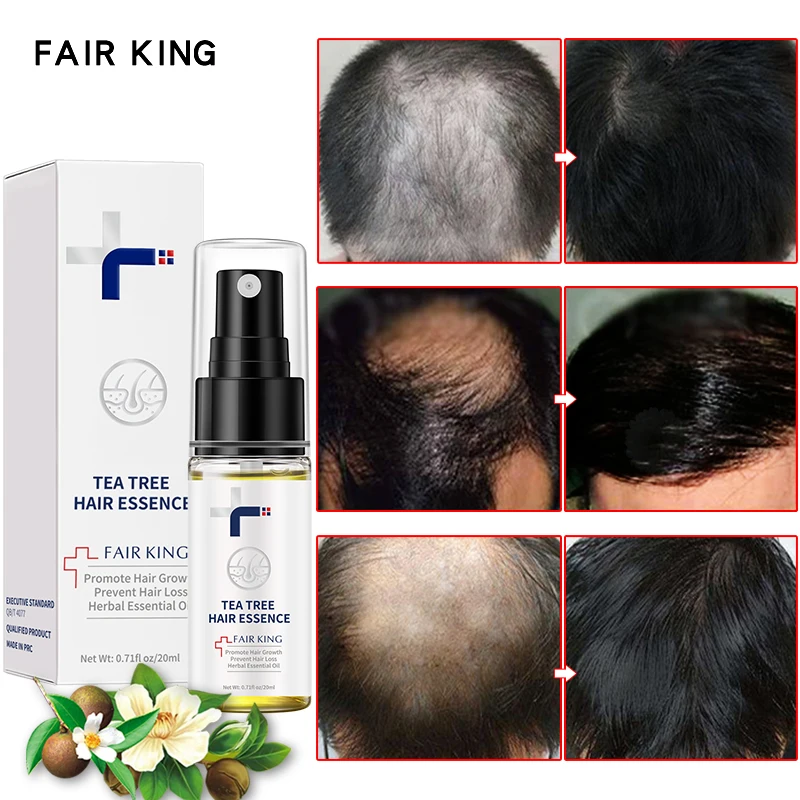 Hair Growth Essential Oil Spray Serum Hair Treatment Anti Lost Beauty Products Fast Grow Repair Scalp Frizzy Damaged Hair Care
Hair Growth Essential Oil Spray Serum Hair Treatment Anti Lost Beauty Products Fast Grow Repair Scalp Frizzy Damaged Hair Care