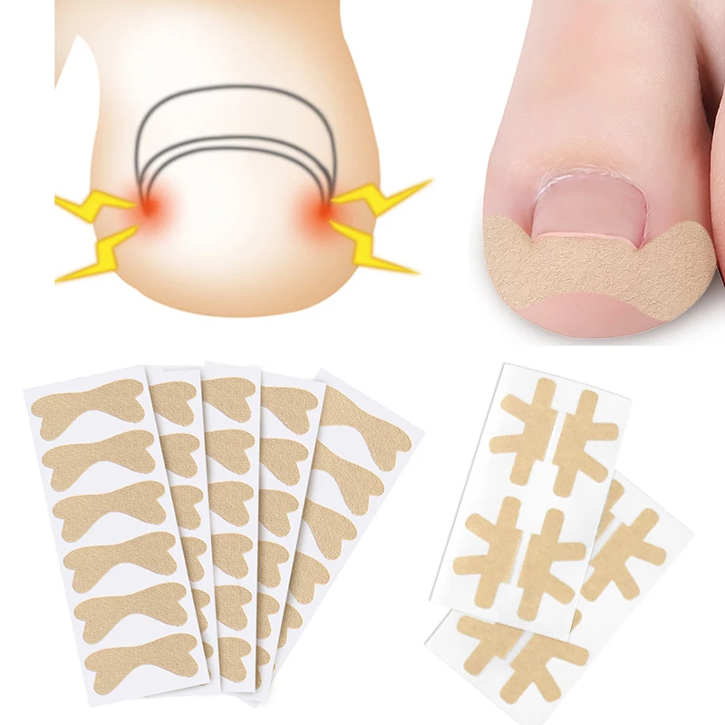 12-4PCS Ingrown Toenail Patches Correction Stickers Ingrown Toenail Correction Pedicure Tools Toenail Inlay Nail Corrector Patch
12-4PCS Ingrown Toenail Patches Correction Stickers Ingrown Toenail Correction Pedicure Tools Toenail Inlay Nail Corrector Patch