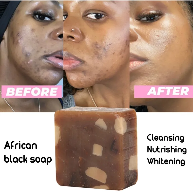 Black Soap Facial Lightening African Soap for Black Skin Magic Whitening Nourish Clean Acne Treatment
Black Soap Facial Lightening African Soap for Black Skin Magic Whitening Nourish Clean Acne Treatment