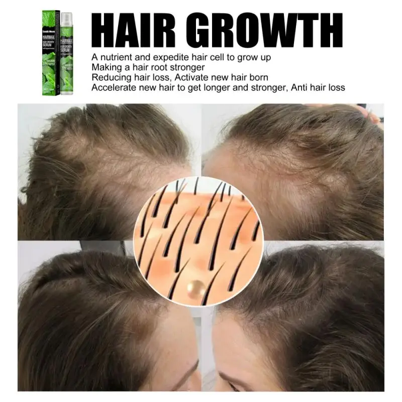 1/3/5PCS Grey Hair Treatment Serum Hair Growth Spray Restoration Black Hair Anti Hair Loss White Hair Repair Hair Loss Product 
1/3/5PCS Grey Hair Treatment Serum Hair Growth Spray Restoration Black Hair Anti Hair Loss White Hair Repair Hair Loss Product