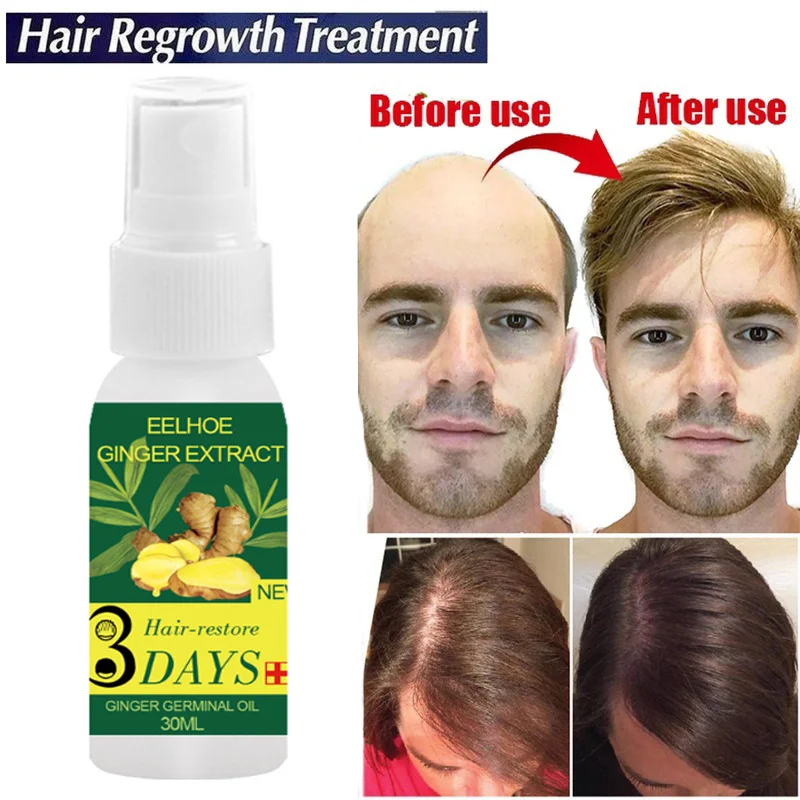 Ginger Hair Growth Spray Serum Fast Grow Hair Essential Oil Anti Hair Loss Products Prevent Hair Thinning Dry Damaged Hair Care
Ginger Hair Growth Spray Serum Fast Grow Hair Essential Oil Anti Hair Loss Products Prevent Hair Thinning Dry Damaged Hair Care