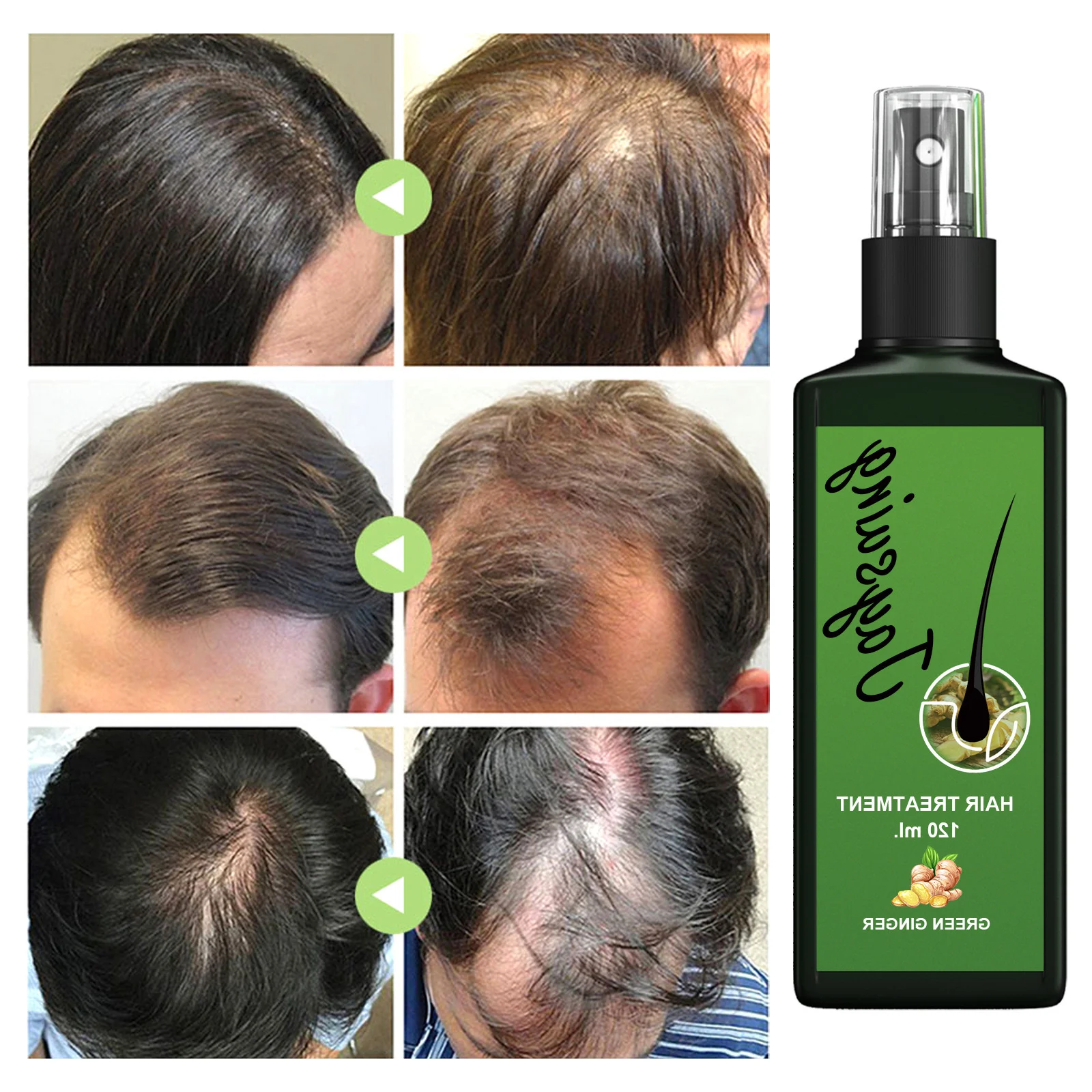Hair Regrowth Lotion Haircare/Hair Loss Oil Baldness Repair Anti Hair Loss Wash-Free Nourishing Hair Root Growth Nutrient
Hair Regrowth Lotion Haircare/Hair Loss Oil Baldness Repair Anti Hair Loss Wash-Free Nourishing Hair Root Growth Nutrient