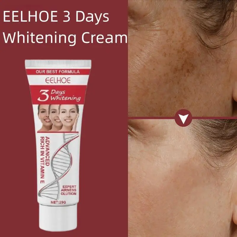 Instant Whitening Freckle Removing Cream Remove Melanin Chloasma Dark Spots Brighten Skin Tone Improve Dullness Repairing Skin
Instant Whitening Freckle Removing Cream Remove Melanin Chloasma Dark Spots Brighten Skin Tone Improve Dullness Repairing Skin