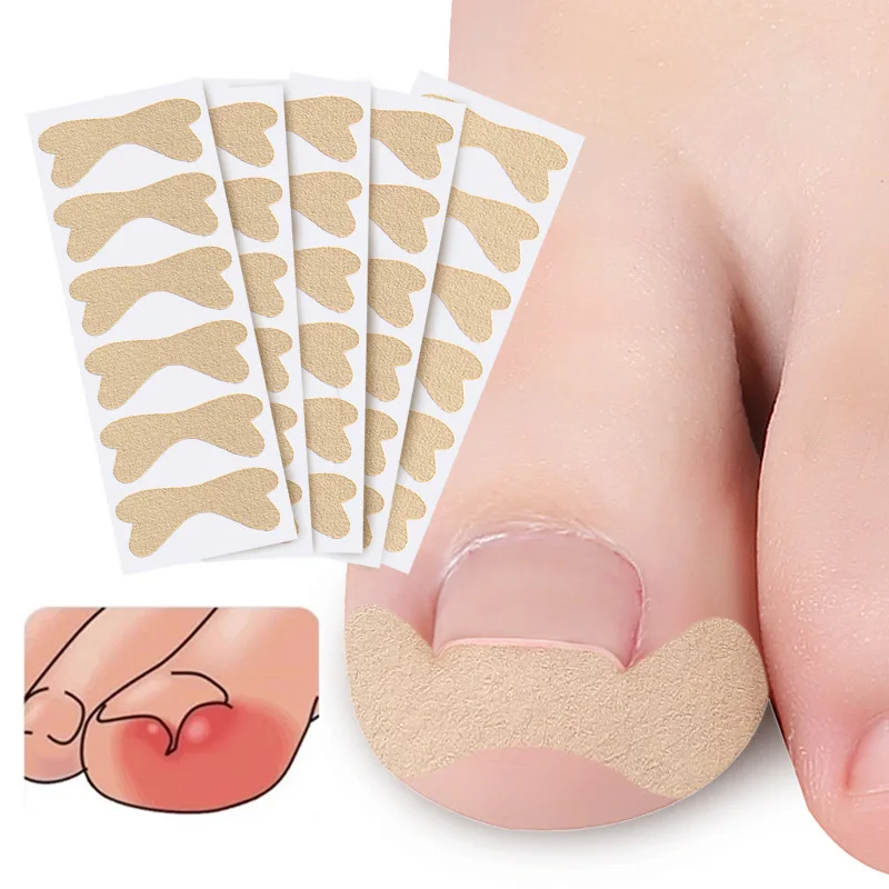 Ingrown Toenail Corrector Stickers Paronychia Treatment Pedicure Toe Nail Care Corrector Patch Correction Stickers 30Pcs
Ingrown Toenail Corrector Stickers Paronychia Treatment Pedicure Toe Nail Care Corrector Patch Correction Stickers 30Pcs