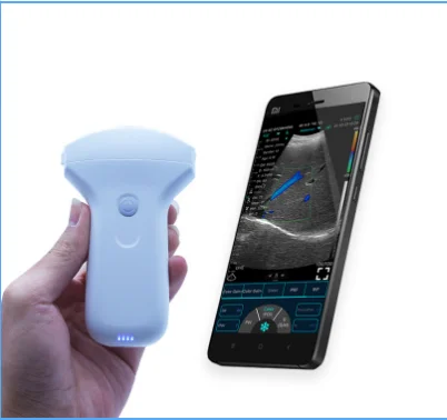 Konted C10UR 128 elements 3.5/5Mhz Convex array probe usd wireless Android ultrasound probe for smartphone
Konted C10UR 128 elements 3.5/5Mhz Convex array probe usd wireless Android ultrasound probe for smartphone