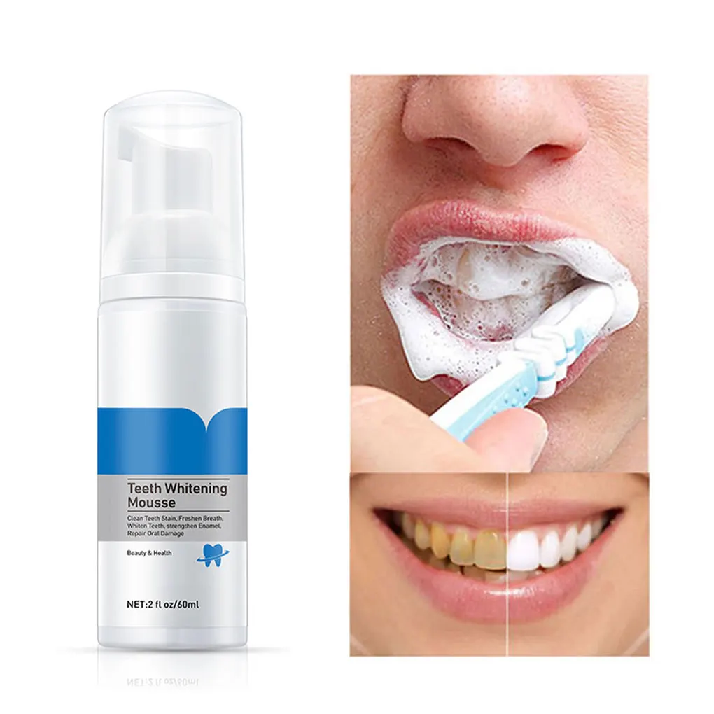 Teeth Whitening Mousse Teeth Cleaning Remove Stains Plaque Tooth White Tool Practical Gifts for Home Traveling
Teeth Whitening Mousse Teeth Cleaning Remove Stains Plaque Tooth White Tool Practical Gifts for Home Traveling