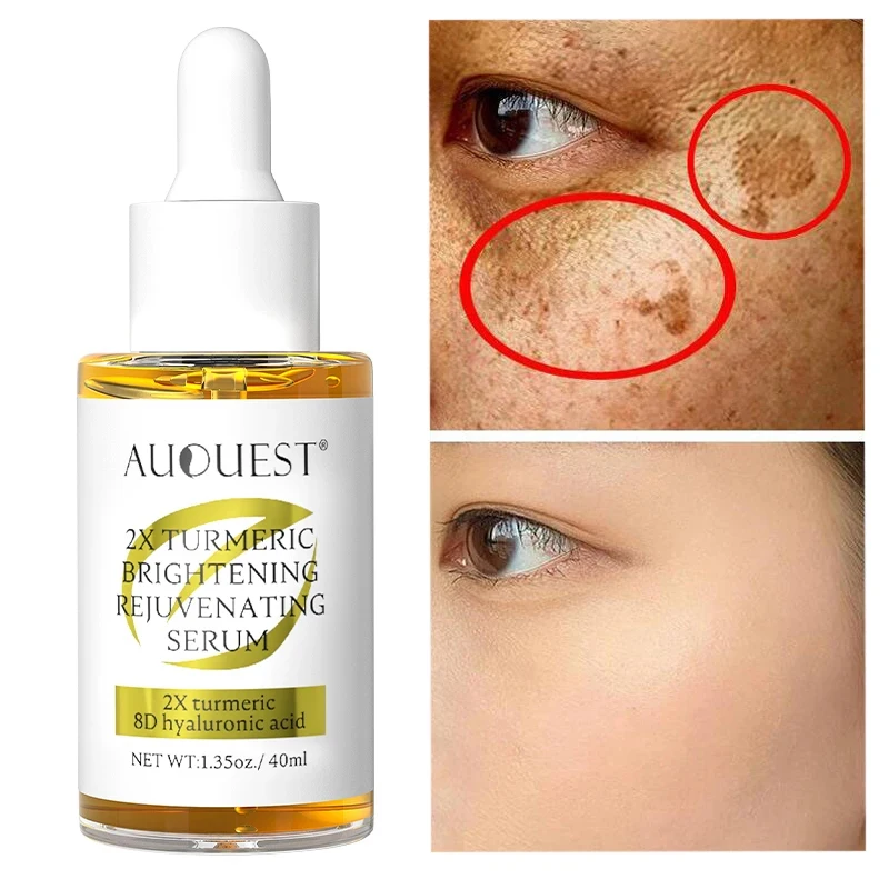 

Turmeric Whitening Freckles Serum Remove Melasma Dark Spot Lightening Melanin Brightening Moisturizing Anti-Aging Face Skin Care