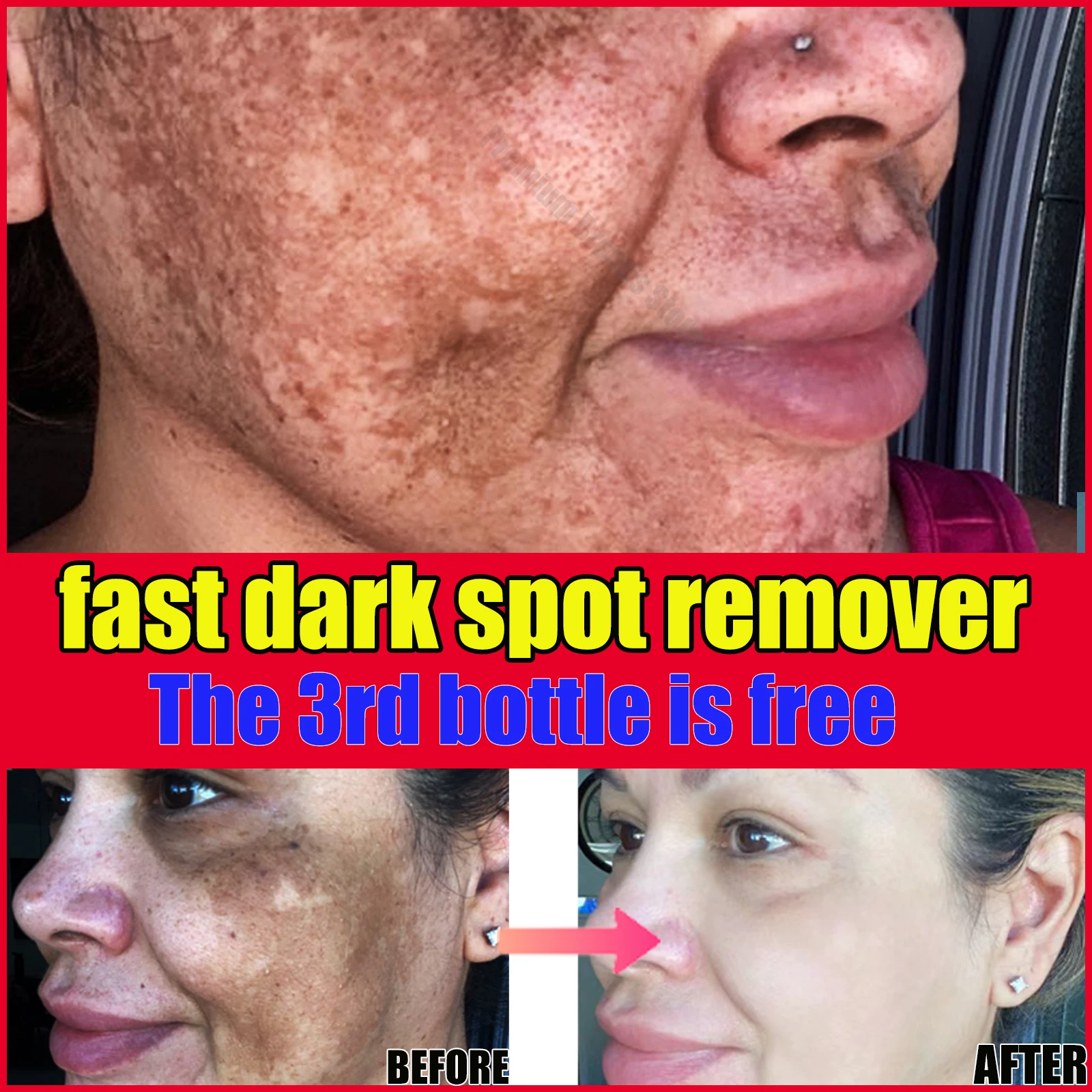 Whitening Freckles Cream Remove Dark Spot Face Cream Lighten Melasma Melanin Pigmentation Anti-Aging Moisturizing Brighten Skin
Whitening Freckles Cream Remove Dark Spot Face Cream Lighten Melasma Melanin Pigmentation Anti-Aging Moisturizing Brighten Skin