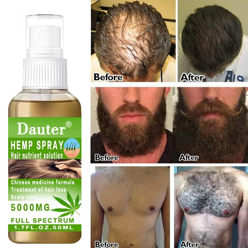 Anti-hair loss essential oil, nourishes damaged hair, quickly grows hair, prevents scalp damage, powerful hair root essence.
Anti-hair loss essential oil, nourishes damaged hair, quickly grows hair, prevents scalp damage, powerful hair root essence.