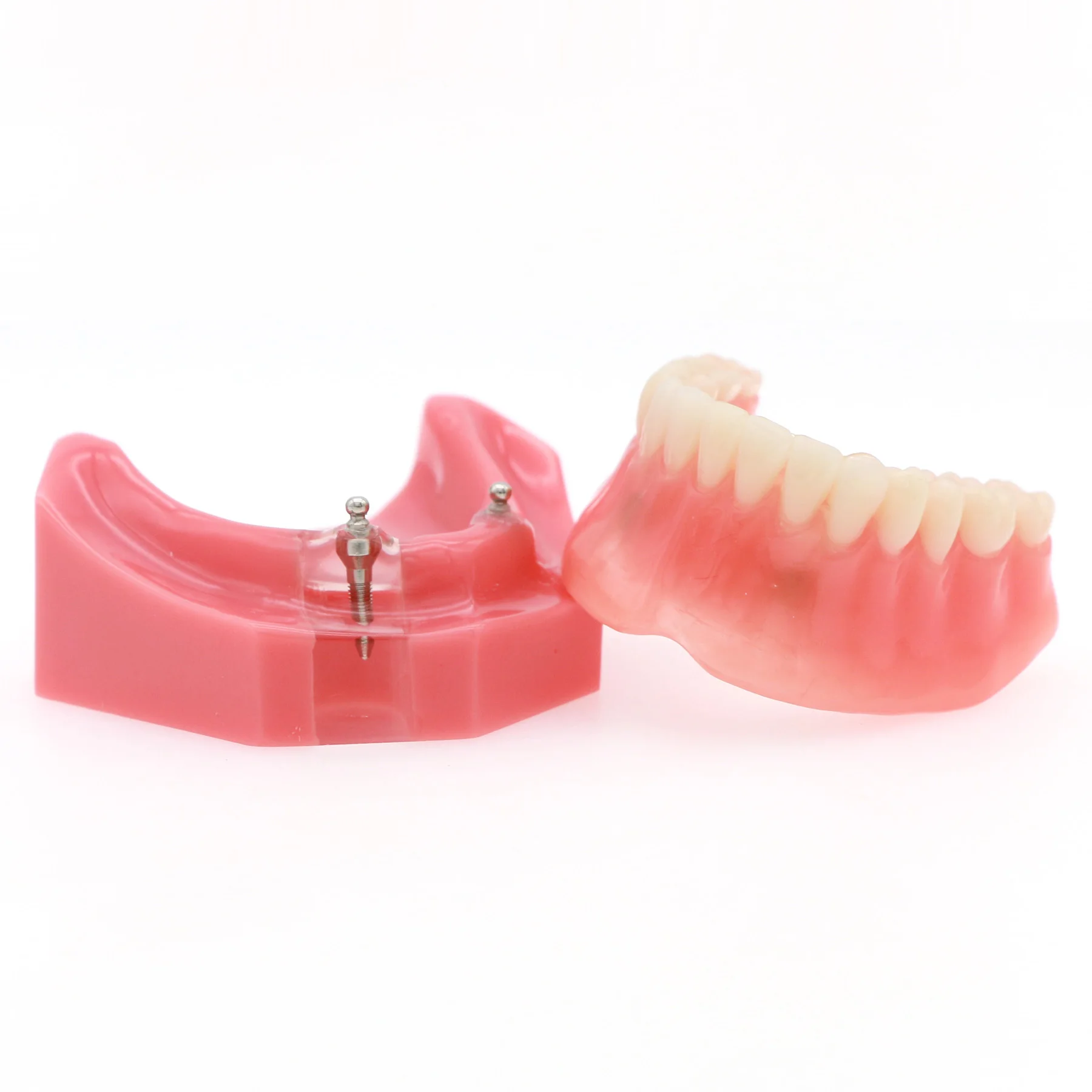 Dental 2 Implants Removable Model Upper Jaw Restoration Overdenture Typodont Teeth Model 6007
Dental 2 Implants Removable Model Upper Jaw Restoration Overdenture Typodont Teeth Model 6007