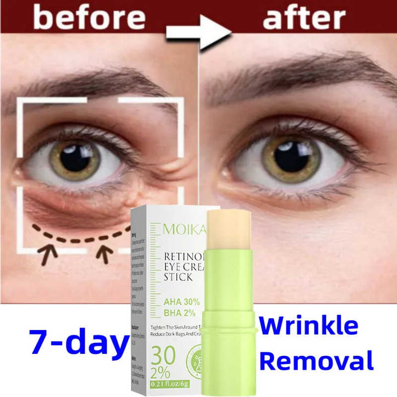 Крем для области вокруг глаз от морщин, тёмных кругов и мешков
Крем для области вокруг глаз от морщин, тёмных кругов и мешков