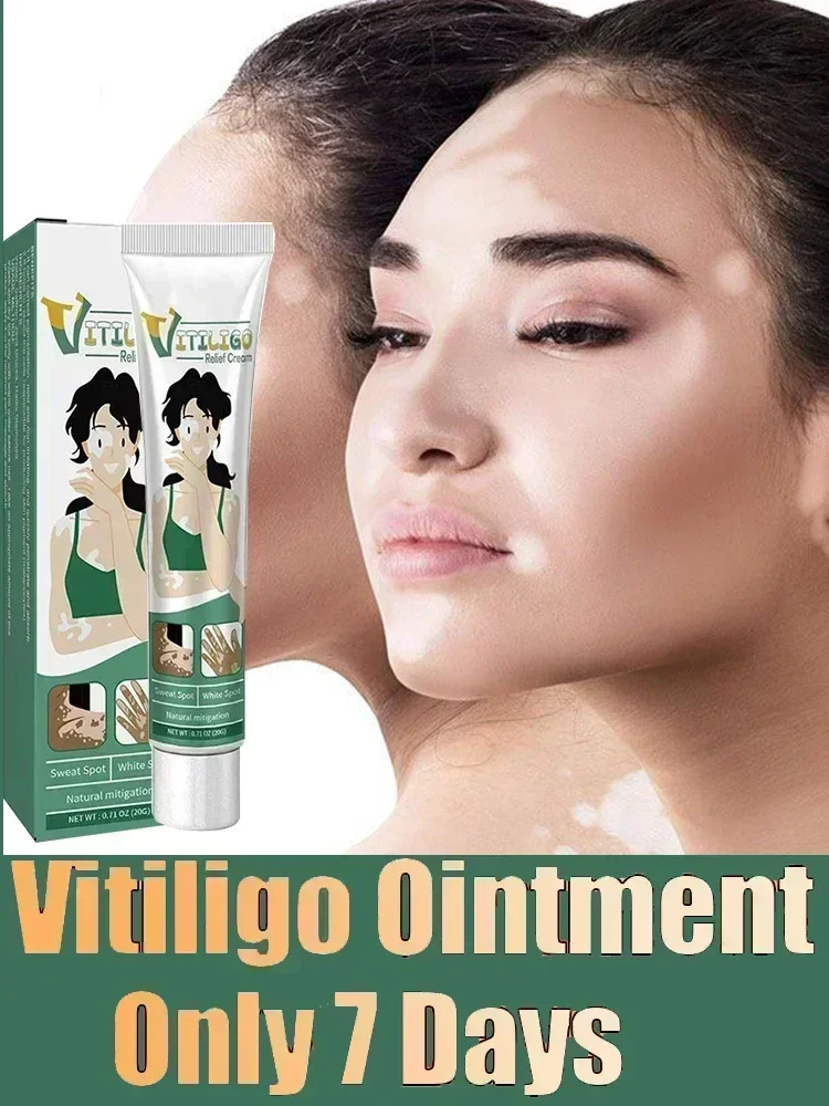 NewWhite Spot for Vitiligo White Spots Leukoplakia Pigmentation Melanin Promoting Skin Care0903