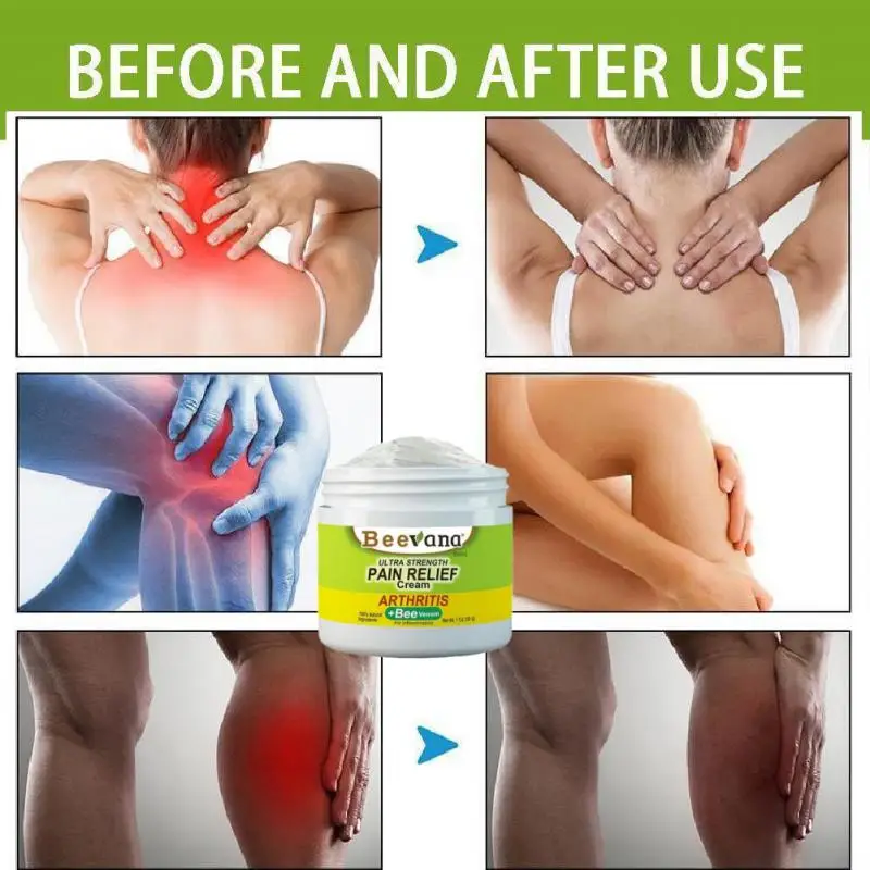 30g Bee Venoms Joint Cream Joint And Bone Therapy Cream Massage Treatments Cream Bone Health Body Care Tools Joint Bone Cream
30g Bee Venoms Joint Cream Joint And Bone Therapy Cream Massage Treatments Cream Bone Health Body Care Tools Joint Bone Cream