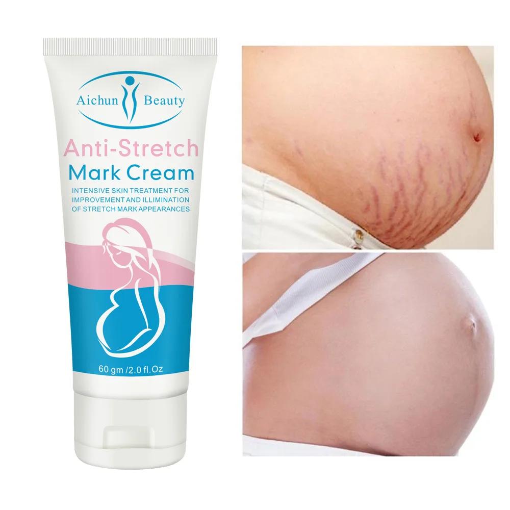 Effective Stretch Mark Removal Cream Pregnant Women Pregnancy Stretch Marks Fat Fade Fine Lines Smooth Skin Whitening Body Care
Effective Stretch Mark Removal Cream Pregnant Women Pregnancy Stretch Marks Fat Fade Fine Lines Smooth Skin Whitening Body Care