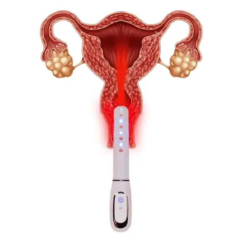 Cold Laser Vaginal Reserve Tightening Machine Vibration Wand Home Use Medical Apparatus Gynecology Women Infection Treatment
Cold Laser Vaginal Reserve Tightening Machine Vibration Wand Home Use Medical Apparatus Gynecology Women Infection Treatment