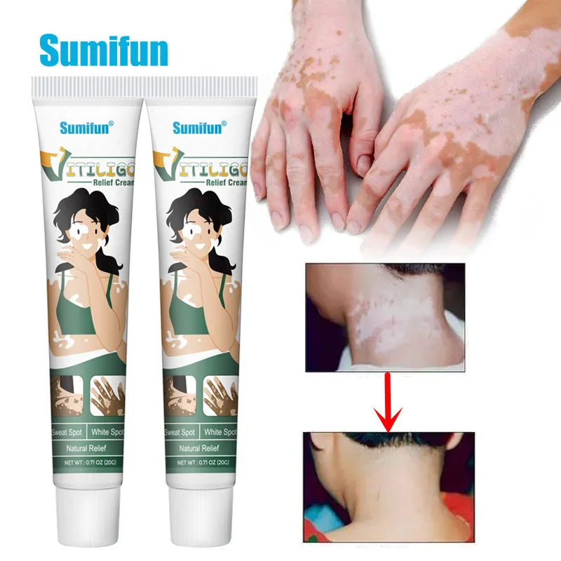 Sumifun 20g Herbal Extract Vitiligo Ointment Remove Ringworm White Spot Removal Skin Care Leukoplakia Disease Treatment Cream
Sumifun 20g Herbal Extract Vitiligo Ointment Remove Ringworm White Spot Removal Skin Care Leukoplakia Disease Treatment Cream