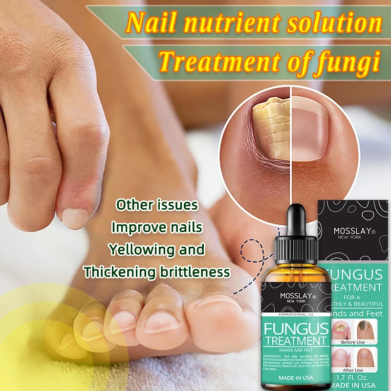 50ml Fungal Nail Repair Essence Serum Care Treatment Foot Nail Fungus Removal Gel Anti Infection Paronychia Onychomycosis Care
50ml Fungal Nail Repair Essence Serum Care Treatment Foot Nail Fungus Removal Gel Anti Infection Paronychia Onychomycosis Care