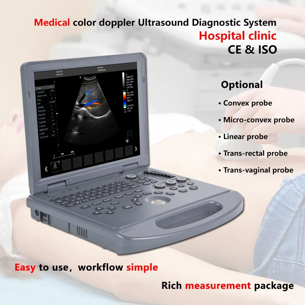 K3 Laptop Color Doppler Ultrasound Scanner 15 Inches with Win7 Platform PW THI CFM PDI DPDI HPRF Rich Optional Transducers 4D
K3 Laptop Color Doppler Ultrasound Scanner 15 Inches with Win7 Platform PW THI CFM PDI DPDI HPRF Rich Optional Transducers 4D