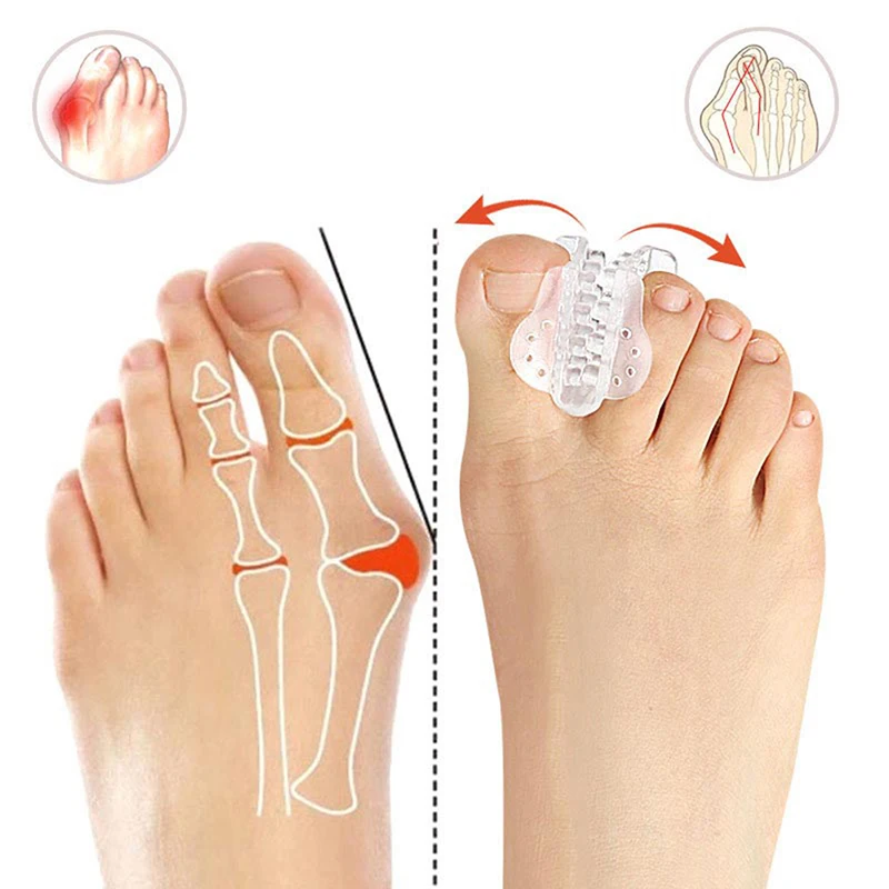 Silicone Toe Separators Feet Care Protector Silicone Toe Orthopedic Products Bunion Corrector Hallux Valgus Pedicure foot care
Silicone Toe Separators Feet Care Protector Silicone Toe Orthopedic Products Bunion Corrector Hallux Valgus Pedicure foot care