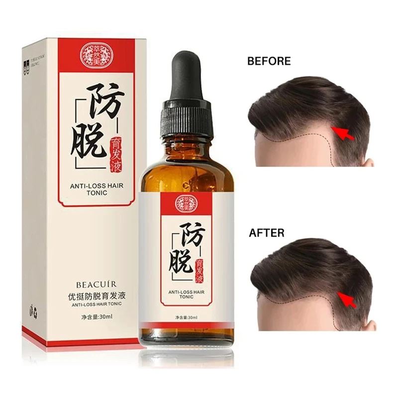 Hair Care Hair Growth Essential Oils Essence Original Authentic 100% Hair Loss Liquid Health Care Beauty Dense Hair Growth Serum
Hair Care Hair Growth Essential Oils Essence Original Authentic 100% Hair Loss Liquid Health Care Beauty Dense Hair Growth Serum