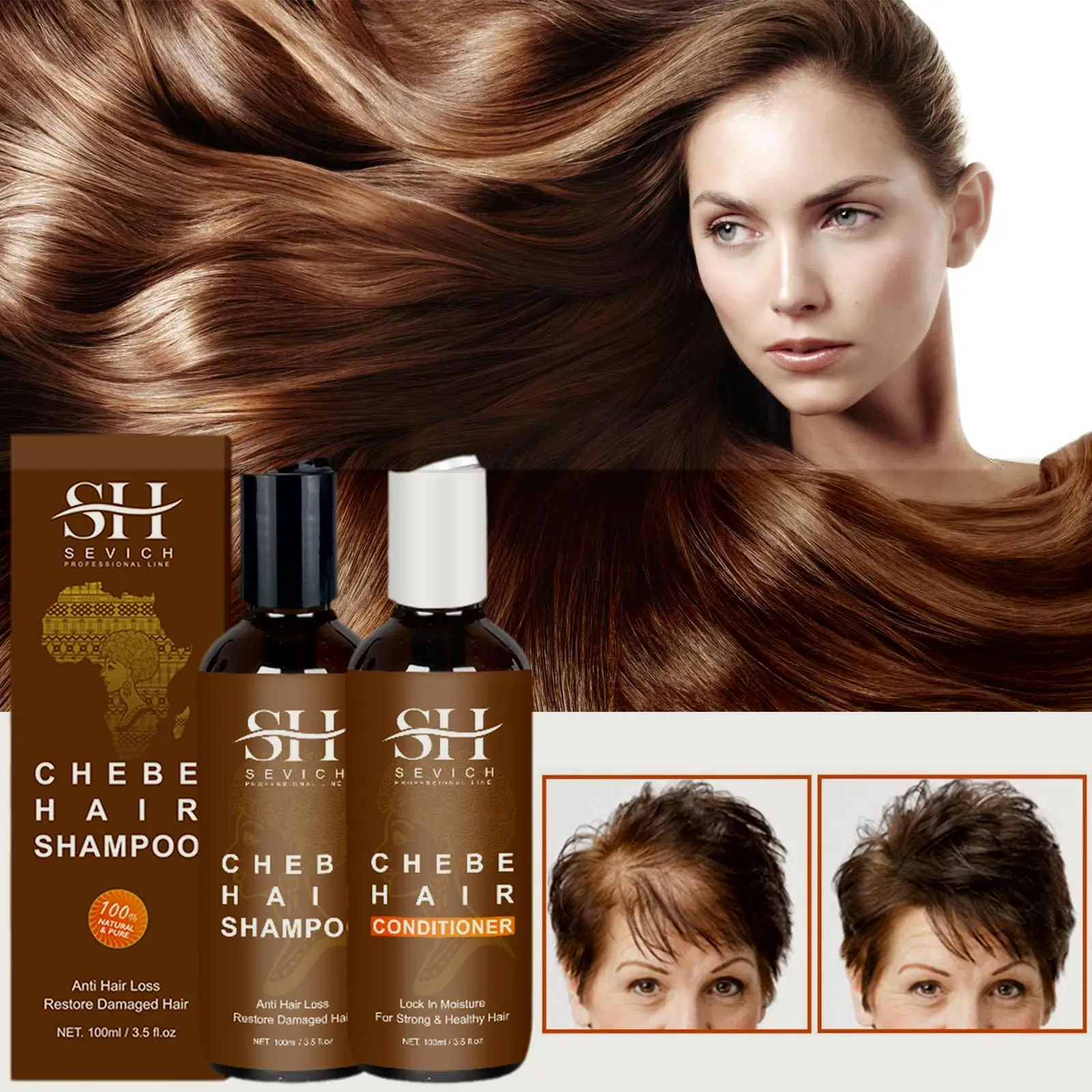 100ml Hair Loss Treatment Shampoo Traction Alopecia Hair Products Hair Conditioner Break Anti Growth I8G9
100ml Hair Loss Treatment Shampoo Traction Alopecia Hair Products Hair Conditioner Break Anti Growth I8G9