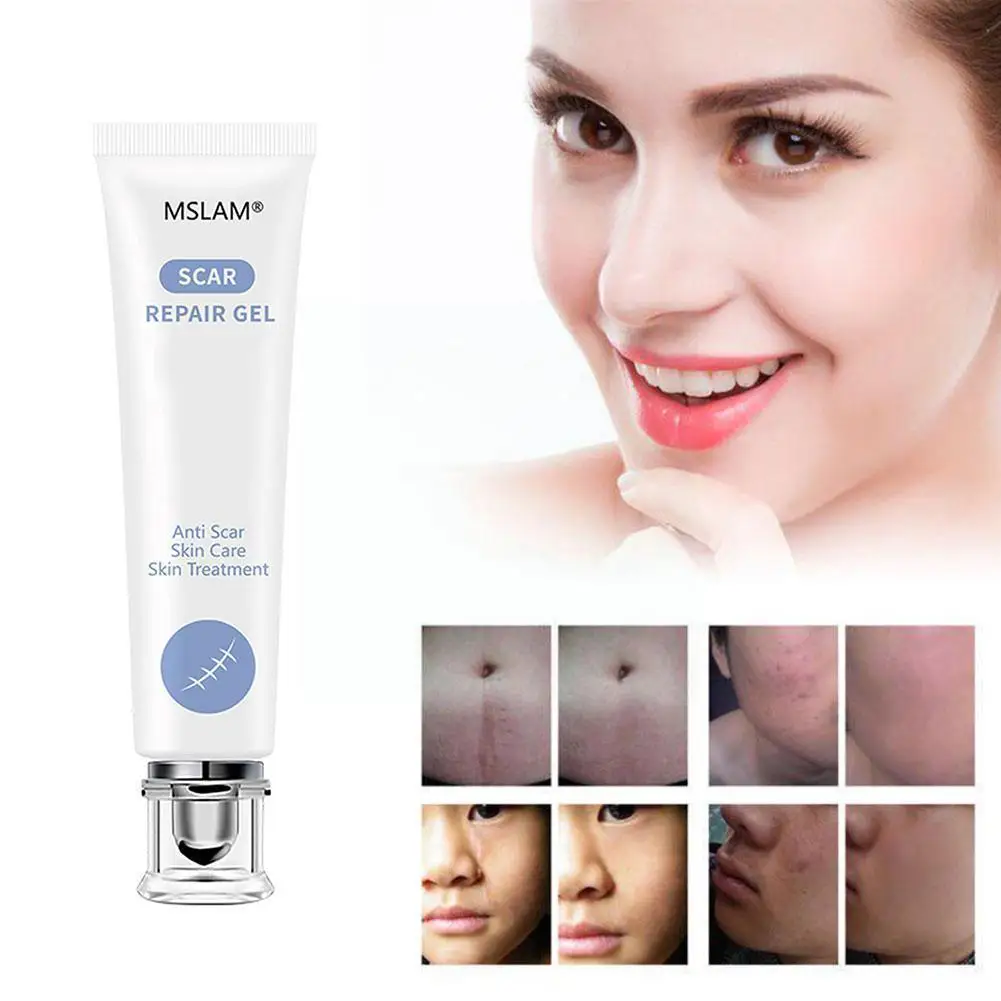 20g MSLAM Scar Repair Gel Removal Scar Acne Cream Treatment Marks For Face Body Pigmentation Corrector Skin G4W7
20g MSLAM Scar Repair Gel Removal Scar Acne Cream Treatment Marks For Face Body Pigmentation Corrector Skin G4W7