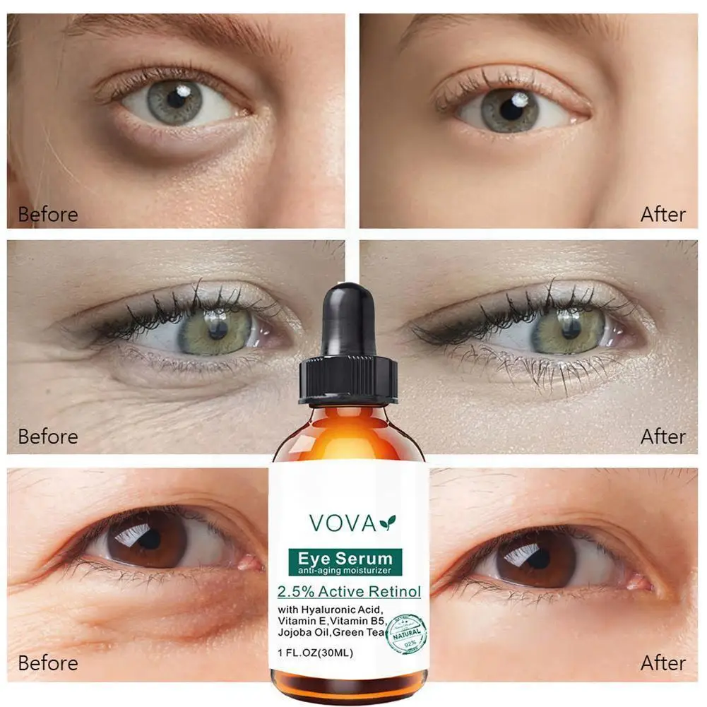 Instant Remove Eye Bags Serum Retinol Cream Anti Puffiness Aging Firming Delays Fades Wrinkles Brighten Dark Circles Skin G E7z3
Instant Remove Eye Bags Serum Retinol Cream Anti Puffiness Aging Firming Delays Fades Wrinkles Brighten Dark Circles Skin G E7z3