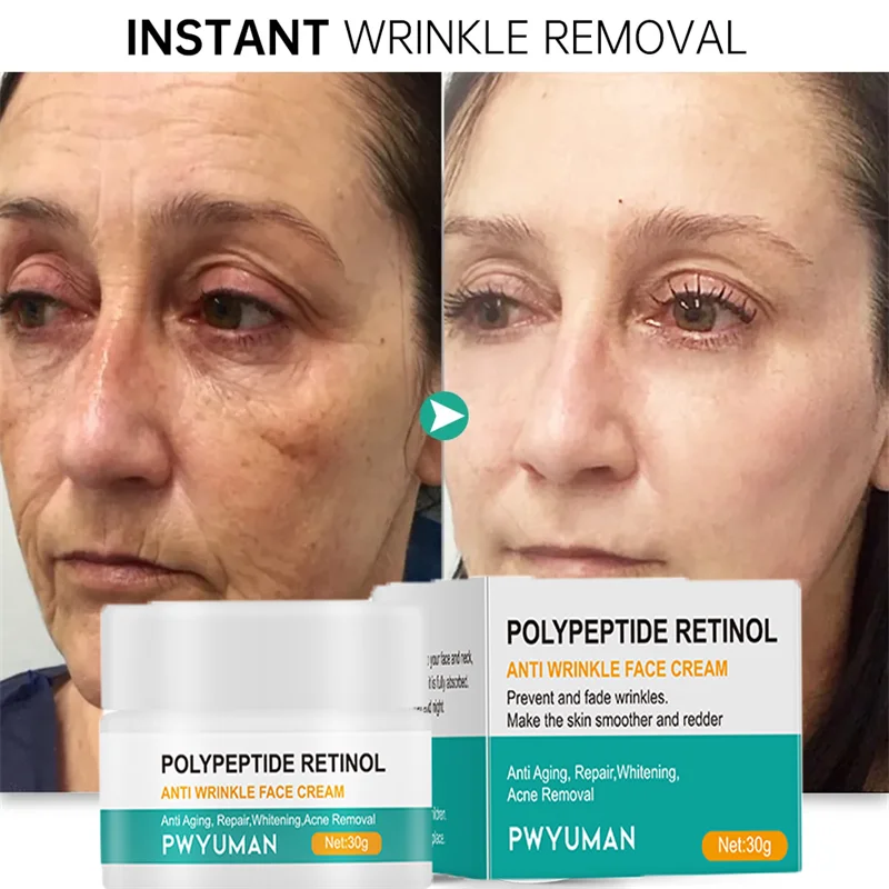 Fast Anti-wrinkle Facial Cream Eliminate All Wrinkles Fine Lines Eyes Neck Forehead Wrinkles Lifting Firming Cream White Skin
Fast Anti-wrinkle Facial Cream Eliminate All Wrinkles Fine Lines Eyes Neck Forehead Wrinkles Lifting Firming Cream White Skin